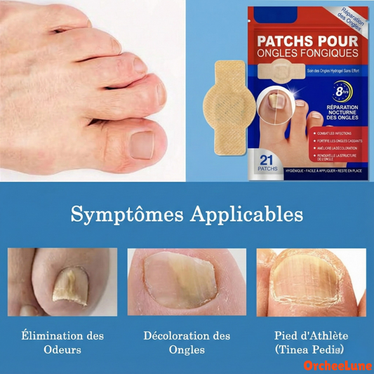 Le seul traitement contre les mycoses des ongles